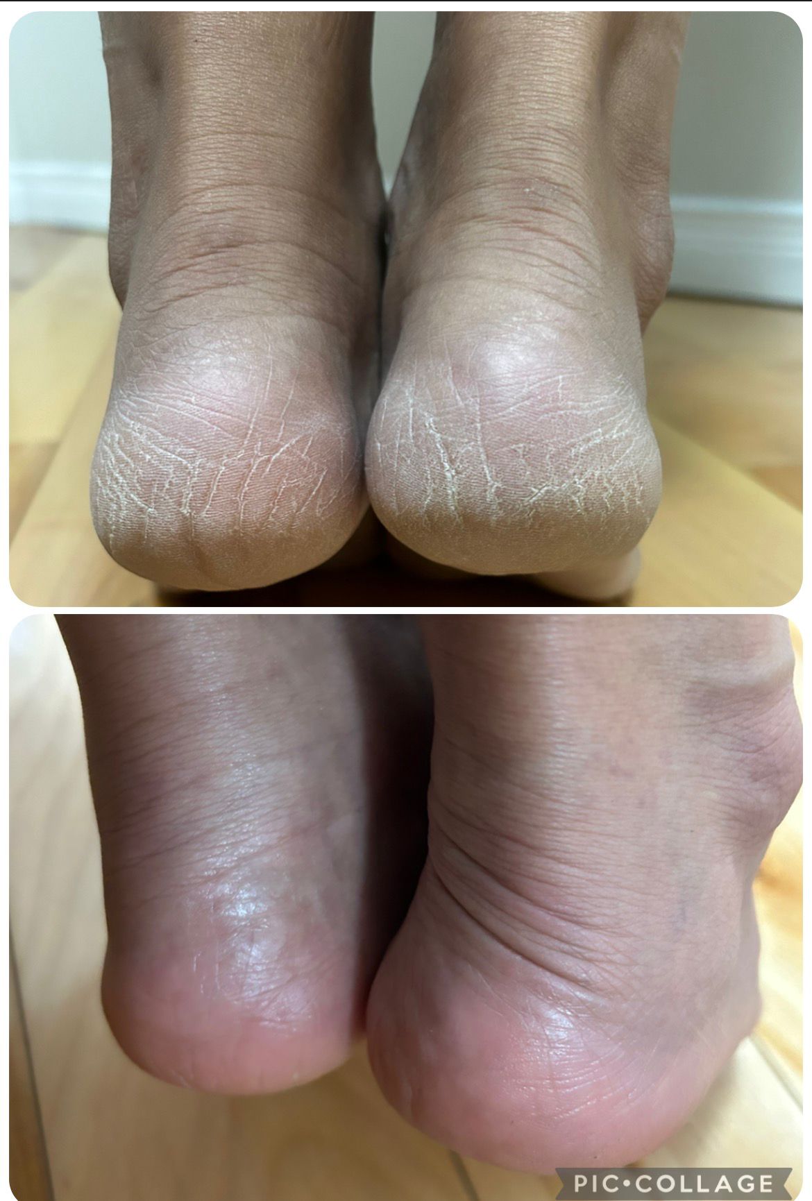 Foot Cream